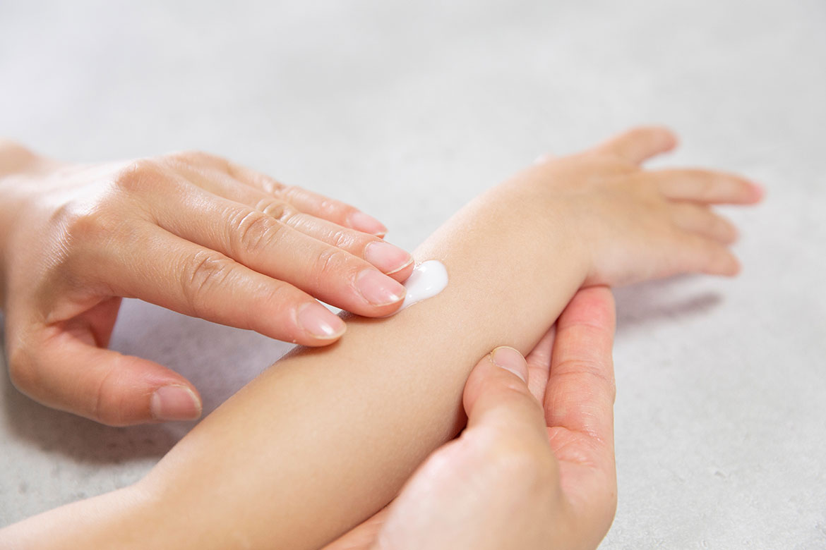 アトピー性皮膚炎